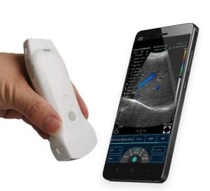 Portable Handheld Color Doppler Ultrasound Scanner :